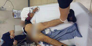 Primer Homicidio De Julio En Apatzingán; Joven Muere Tras Ataque A Balazos