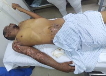 ¿Conoces La Nueva Boleta Para Primarias? See La Explica