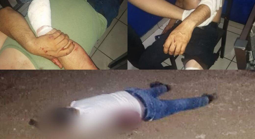 Atención Ciudadana Por Disparos En Buenavista Culmina  En Enfrentamiento; Hay Dos Policías Lesionados Y Un Civil Muerto