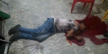 Patrulla Municipal Atropella A Motociclista Cerca Del Cereso En Uruapan