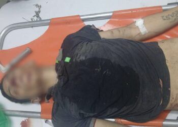 Herido En Tiroteo Tras Disputa En Gabriel Zamora