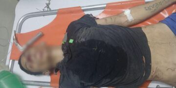 Joven Motociclista Fallece Tras Ser Atropellado Durante Presunta Huida En Apatzingán 26 Herido En Tiroteo Tras Disputa En Gabriel Zamora