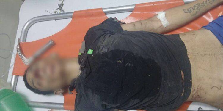 Herido en Tiroteo Tras Disputa en Gabriel Zamora