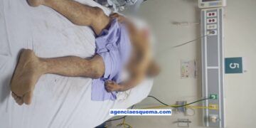 Muere En Apatzingán Al Caerle Un Portón Encima 18 Borrador Automático