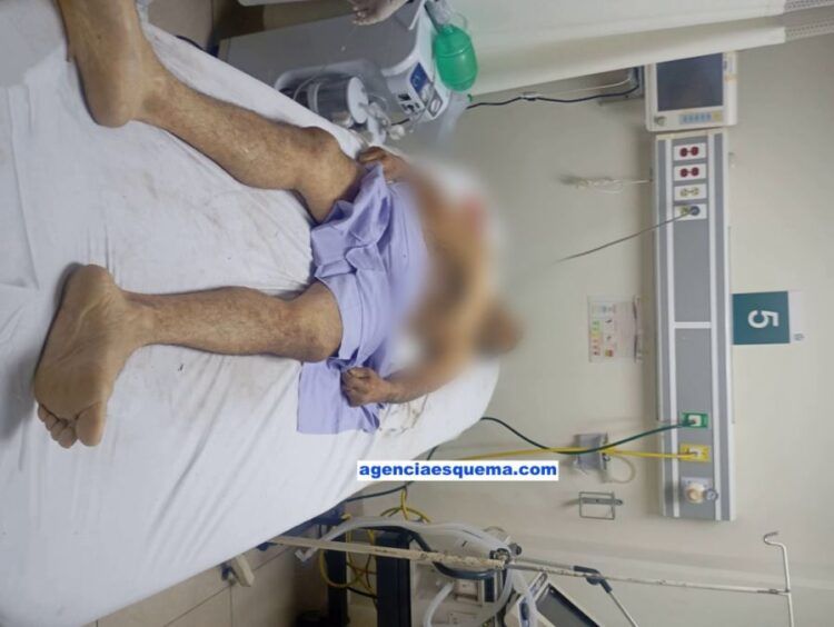 Muere En Apatzingan Al Caerle Un Porton Encima - El Día De Michoacán