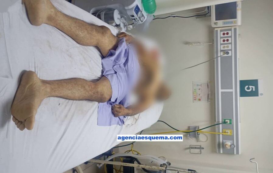 Muere En Apatzingan Al Caerle Un Porton Encima - El Día De Michoacán