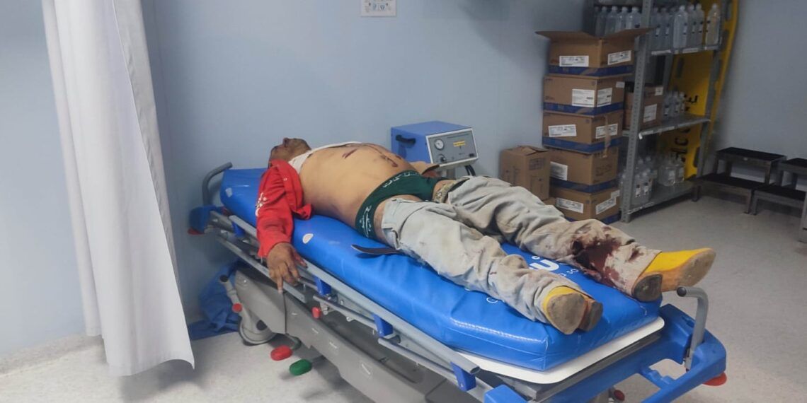 Muere Jinete Al Ser Pisoteado Por Un Toro En Un Jaripeo De Tarímbaro 19 Muere Jinete En Jaripeo De Tarimbaro - El Día De Michoacán