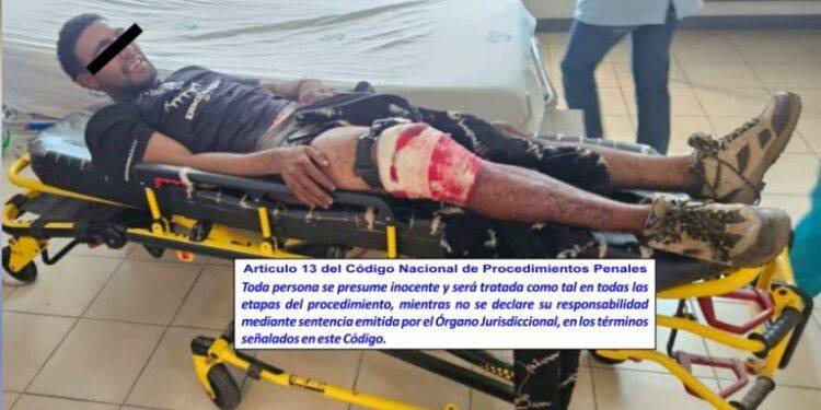 Venezolano capturado herido de varios impactos de Bala en Operativo en Cerro Blanco de Apatzingán 1 Venezolano capturado herido de varios impactos de Bala A - El día de Michoacán