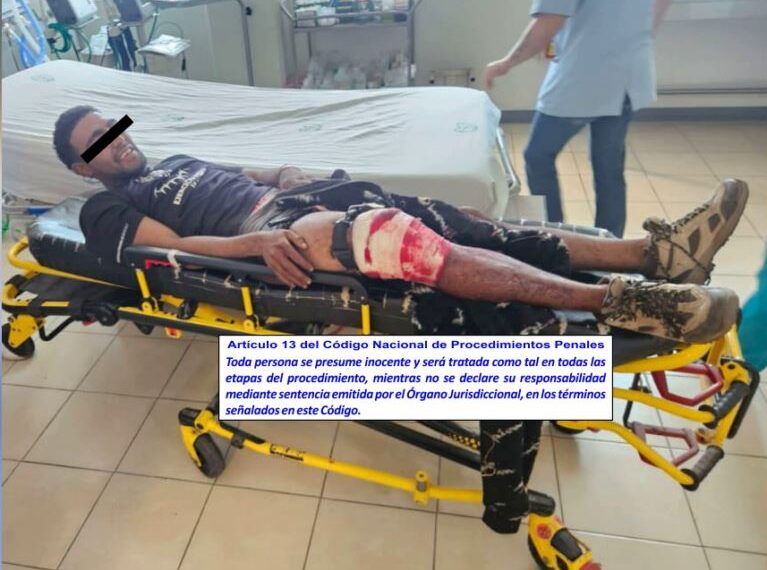 Venezolano Capturado Herido De Varios Impactos De Bala En Operativo En Cerro Blanco De Apatzingán 19 Venezolano Capturado Herido De Varios Impactos De Bala A - El Día De Michoacán