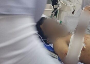 Menor Baleado Sigue Luchando Por Su Vida Tras Brutal Ataque En Apatzingan - El Día De Michoacán