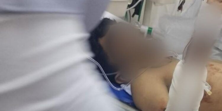 Menor Baleado Sigue Luchando Por Su Vida Tras Brutal Ataque En Apatzingan - El Día De Michoacán