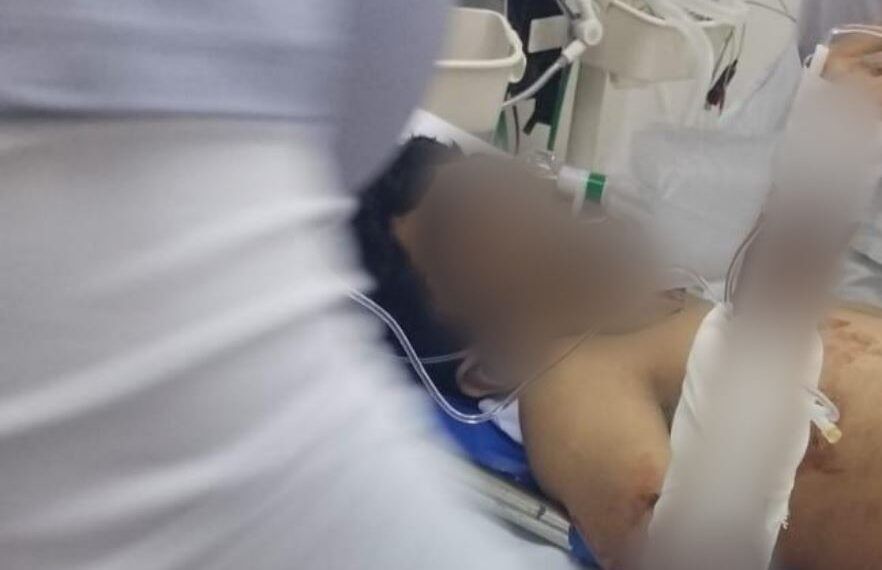 Menor Baleado Sigue Luchando Por Su Vida Tras Brutal Ataque En Apatzingan - El Día De Michoacán