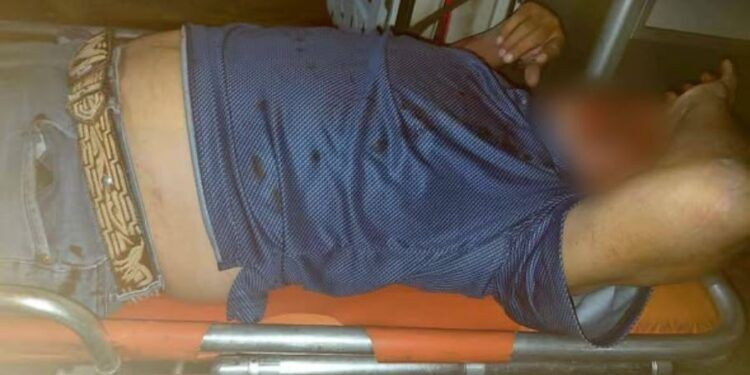 Motociclista queda tendido y desorientado tras brutal derrape en avenida Madero de Apatzingán 1 Detectan primer caso de gusano barrenador en Michoacán