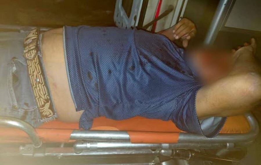 Motociclista Queda Tendido Y Desorientado Tras Brutal Derrape En Avenida Madero De Apatzingán 19 Motociclista Lesionado Tras Derrape En Apatzingan - El Día De Michoacán