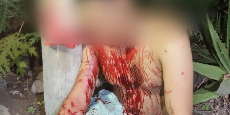 Sangrienta Agresión en plena borrachera en Apatzingán; machetea a compañero de parranda 1 Caen tres con kilo y medio de hierba verde y dosis de cristal en Jacona