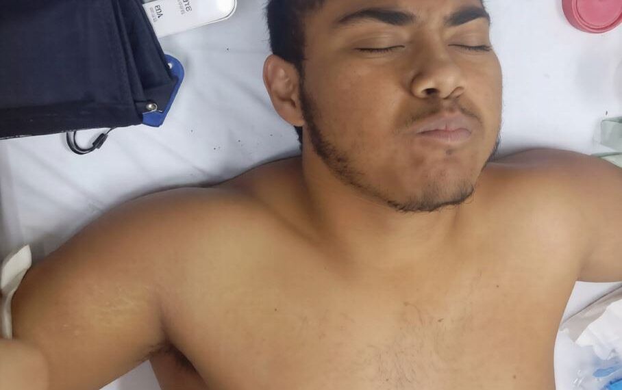 Joven De 19 Anos Sufre Amputacion Tras Activarse Un Artefacto Explosivo En Apatzingan - El Día De Michoacán