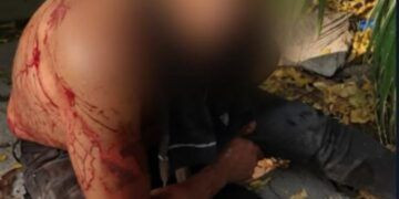 Solitario Sicario En La Vista Hermosa De Apatzingán Baleo A “El Chino”; Recibe 5 Balazos 16 Michoacán Contra La Rabia, Pero Persiste El Reto Ético De La Cobertura Universal