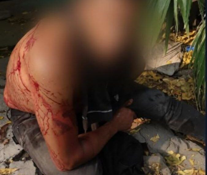 El Chino Herido - El Día De Michoacán