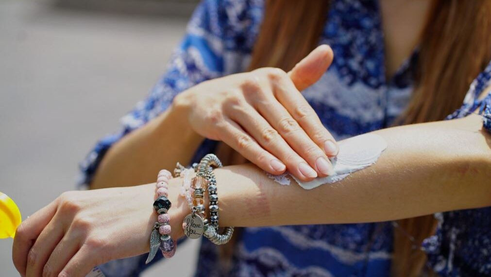 Ssm Llama A Prevenir El Sarpullido Por Altas Temperaturas - El Día De Michoacán