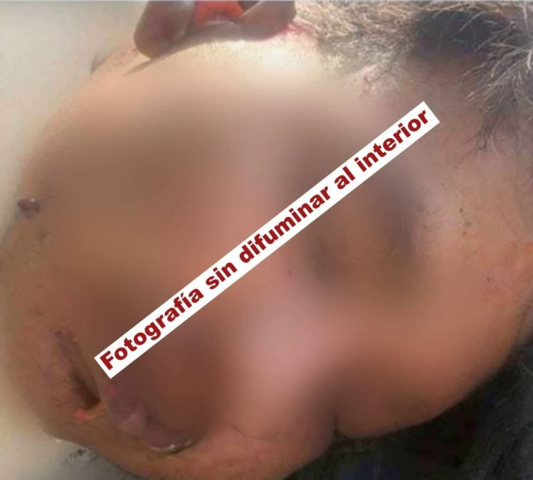 Cabeza Humana Tirada En Apatzingan 1 - El Día De Michoacán