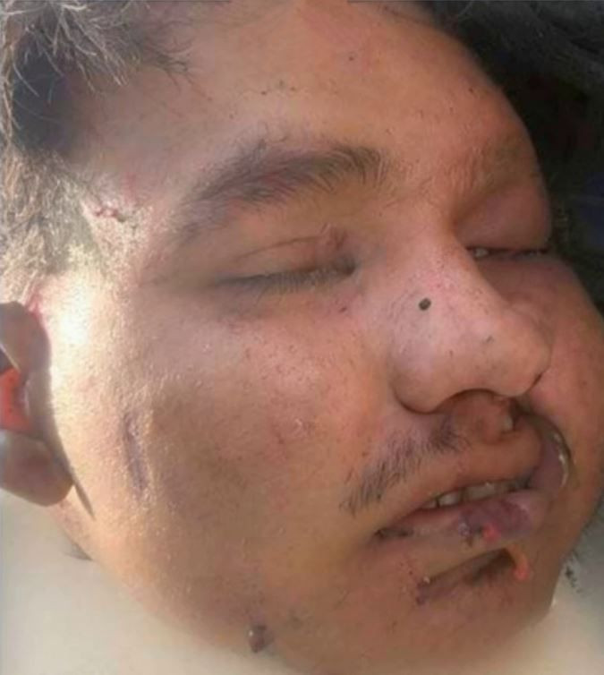 Cabeza Humana Tirada En Apatzingan Interior - El Día De Michoacán