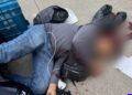 Pareja de motociclistas se sumó a las estadísticas de lesionados por accidentes viales en Motocicleta