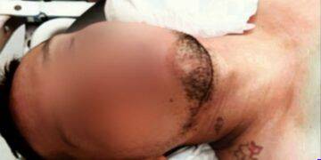 Pareja de motociclistas se sumó a las estadísticas de lesionados por accidentes viales en Motocicleta