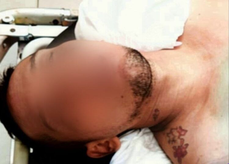Pareja de motociclistas se sumó a las estadísticas de lesionados por accidentes viales en Motocicleta